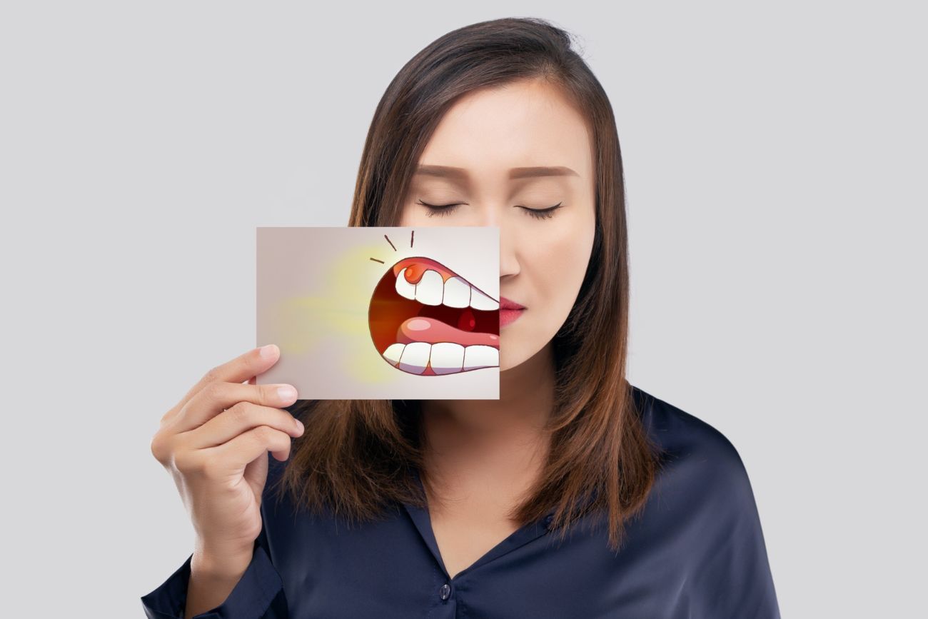 Parodontite e piorrea